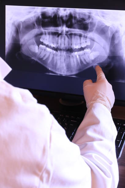 Best Emergency Denture Repair in Savanna, IL