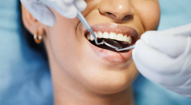 Best Emergency Gum Treatment in Savanna, IL